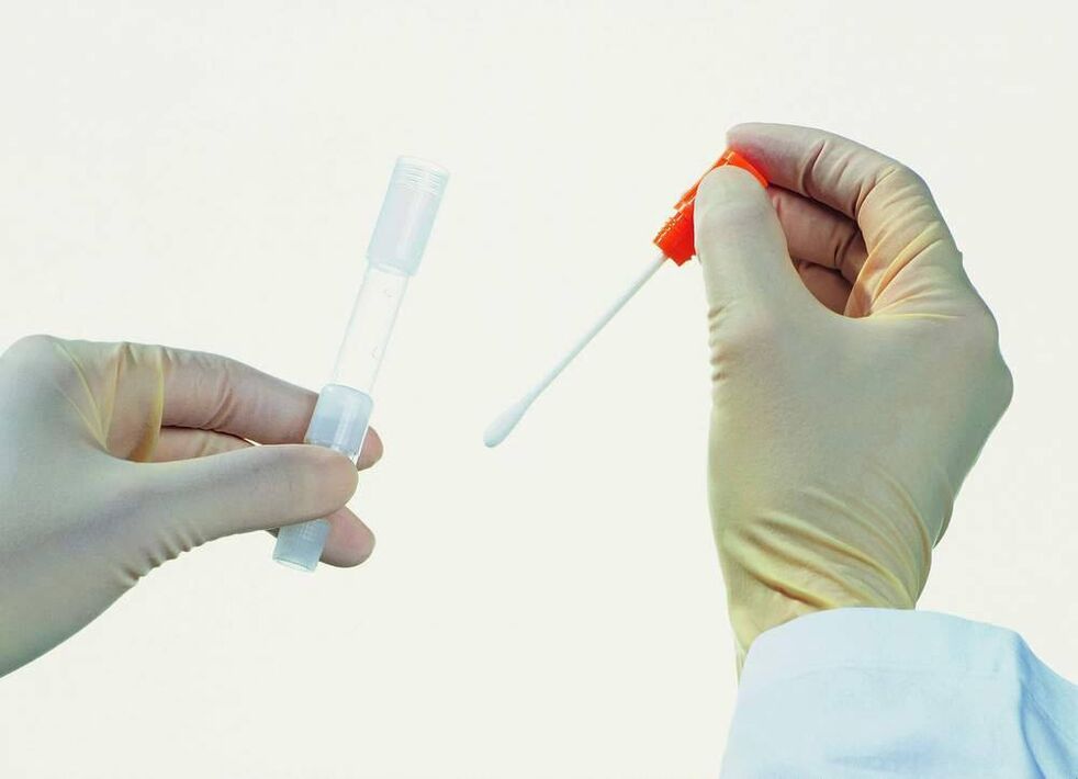 Collecting tests to detect chronic prostatitis