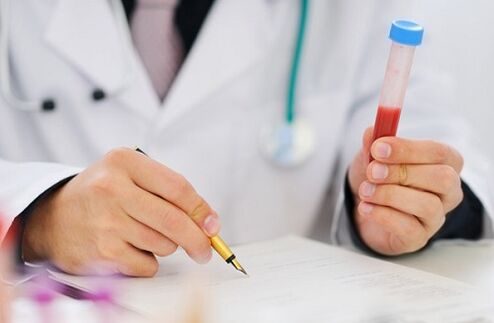 Tests for prostatitis for prescribing medication
